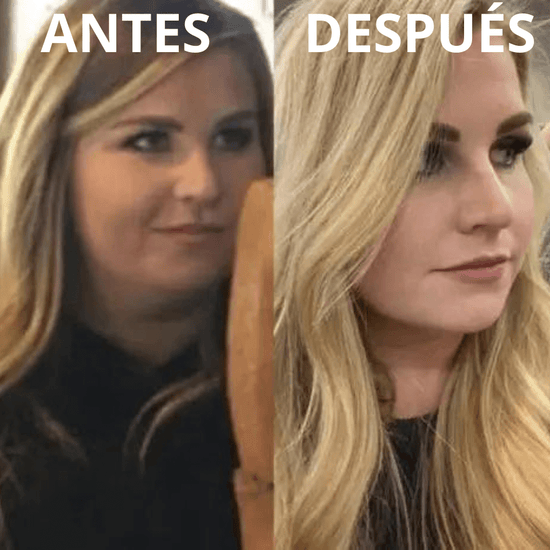 Masajeador Reductor De Papada, Antiarrugas Mejilla, Cuello